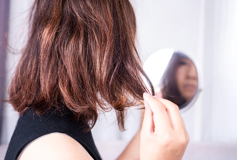 Cosmetic Surgical Treatments for Hair