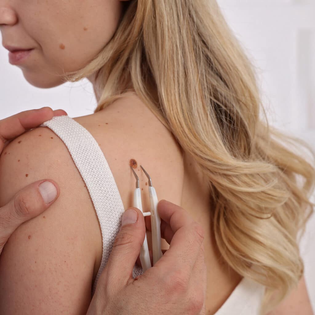 Cosmetic Surgical Treatments